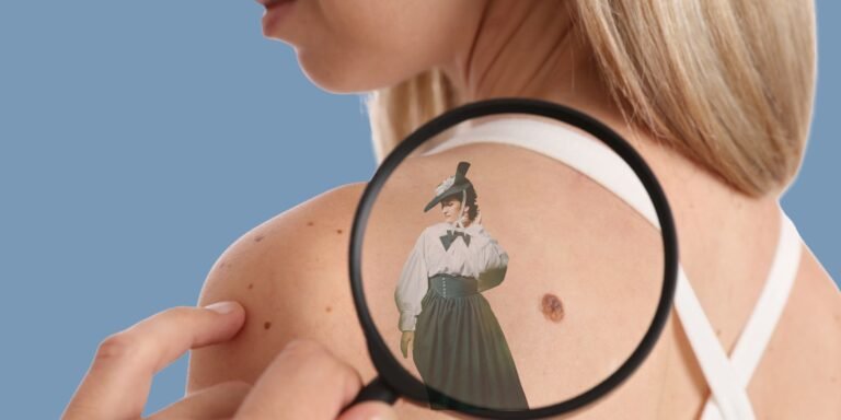 what do birthmarks mean in past life